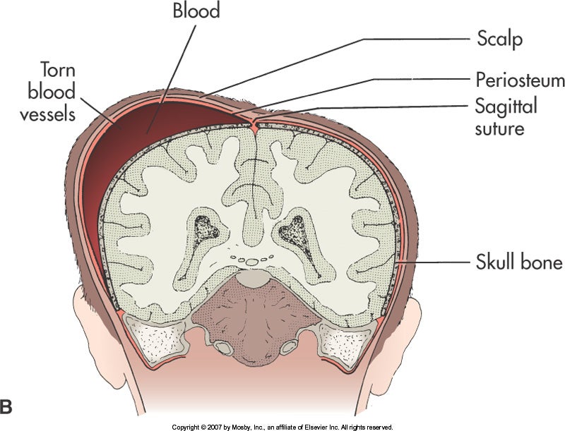 Newborn Assessment